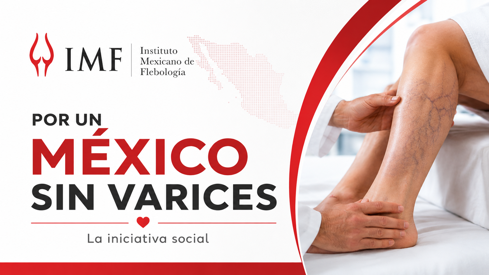 Por Un México Sin Varices - Iniciativa Social del IMF