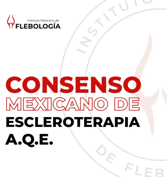 Consenso Mexicano de Escleroterapia - AQE - AMFYL - Ablación Química Endovenosa